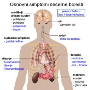 Muko moja zvana candida