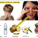 Prirodni lijek za sinuse