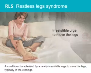 RLS Restless legs syndrome